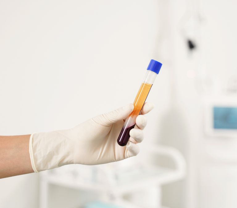 How To Treat Stress Incontinence With Platelet-Rich Plasma Therapy Injections