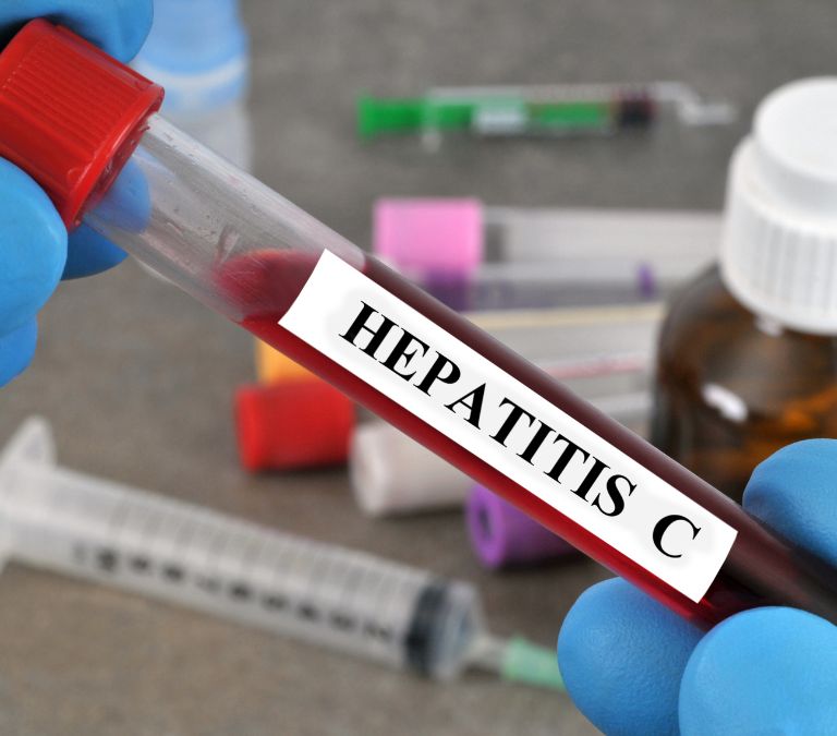 Effects Of Hepatitis C Virus Infection On Menopausal Women And Symptoms